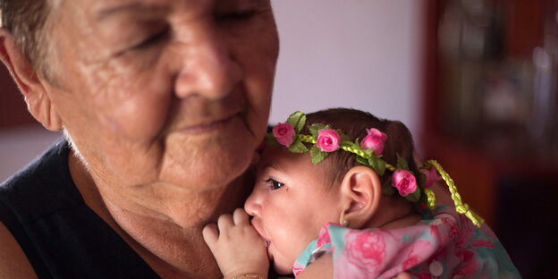 Eine ältere Frau hält ein Baby mit Schädelfehlbildung im Arm