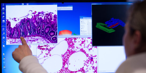 Mann zeigt auf Computerbild mit Gewebeprobe Mann zeigt auf Computerbild mit Gewebeprobe