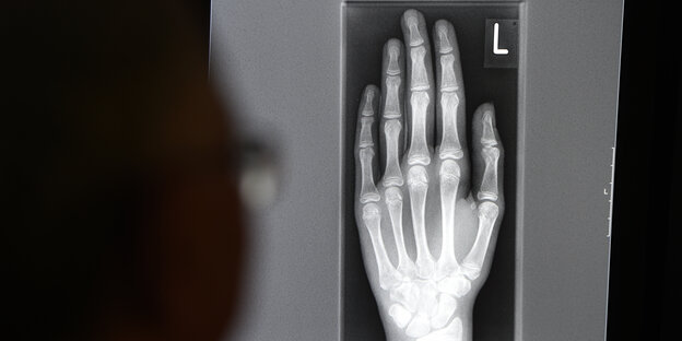 Röntgenbild einer Hand Röntgenbild einer Hand