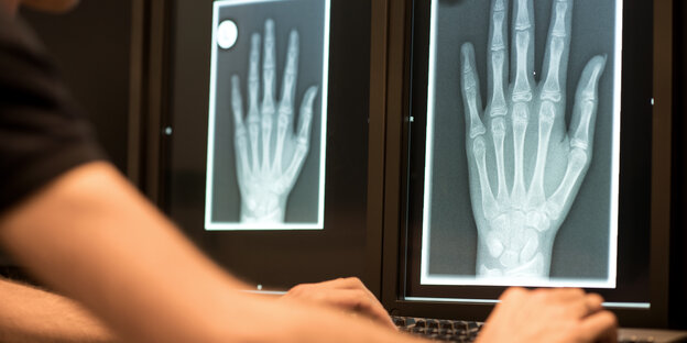 Röntgenbild einer Hand Röntgenbild einer Hand
