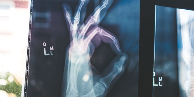 Auf einer Röntgenaufnahme machen Finger ein "OK"-Zeichen Auf einer Röntgenaufnahme machen Finger ein "OK"-Zeichen
