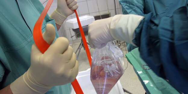 Die Händer zwei Mediziner; einer hält einen Plastibeutel mit einer Niere in der Hand. Die Händer zwei Mediziner; einer hält einen Plastibeutel mit einer Niere in der Hand.