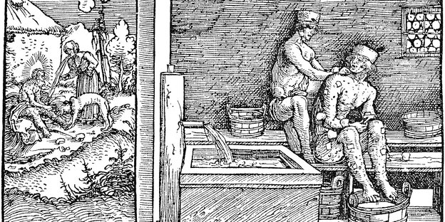Ein mittelalterlicher Stich, der einen Krätze-Erkrankten zeigt. Ein mittelalterlicher Stich, der einen Krätze-Erkrankten zeigt.