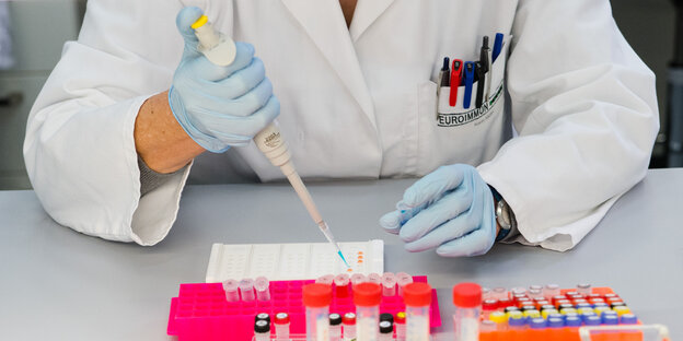 Zwei Hände in Gummihandschuhen führen Laboruntersuchungen mit Regenzgläsern durch. Zwei Hände in Gummihandschuhen führen Laboruntersuchungen mit Regenzgläsern durch.